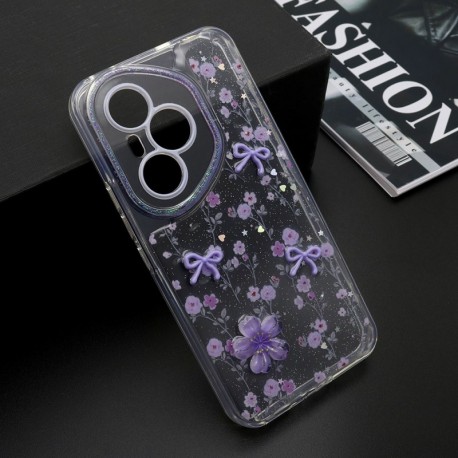 Futrola za Huawei Honor 400 Pro leđa Whisper - ljubičasta