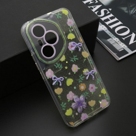 Futrola za Huawei Honor 400 Pro leđa Whisper - žuta