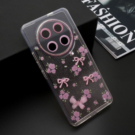 Futrola za Huawei Honor Magic 7 Lite/X9c/X60 Pro leđa Whisper - roza