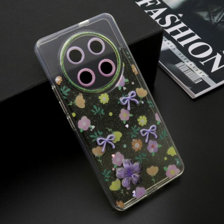 Futrola za Huawei Honor Magic 7 Lite/X9c/X60 Pro leđa Whisper - žuta